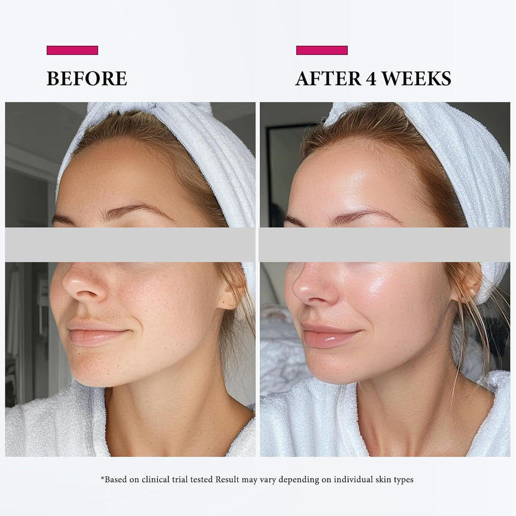 Facial Steamer Nano Ionic: Large 3-In-1 Face Steamer Deep Cleaning Unclogs Pores - Humidifier Towel Steamer Hot Mist Home Sauna Spa for Women Men Sinuses Moisturizing