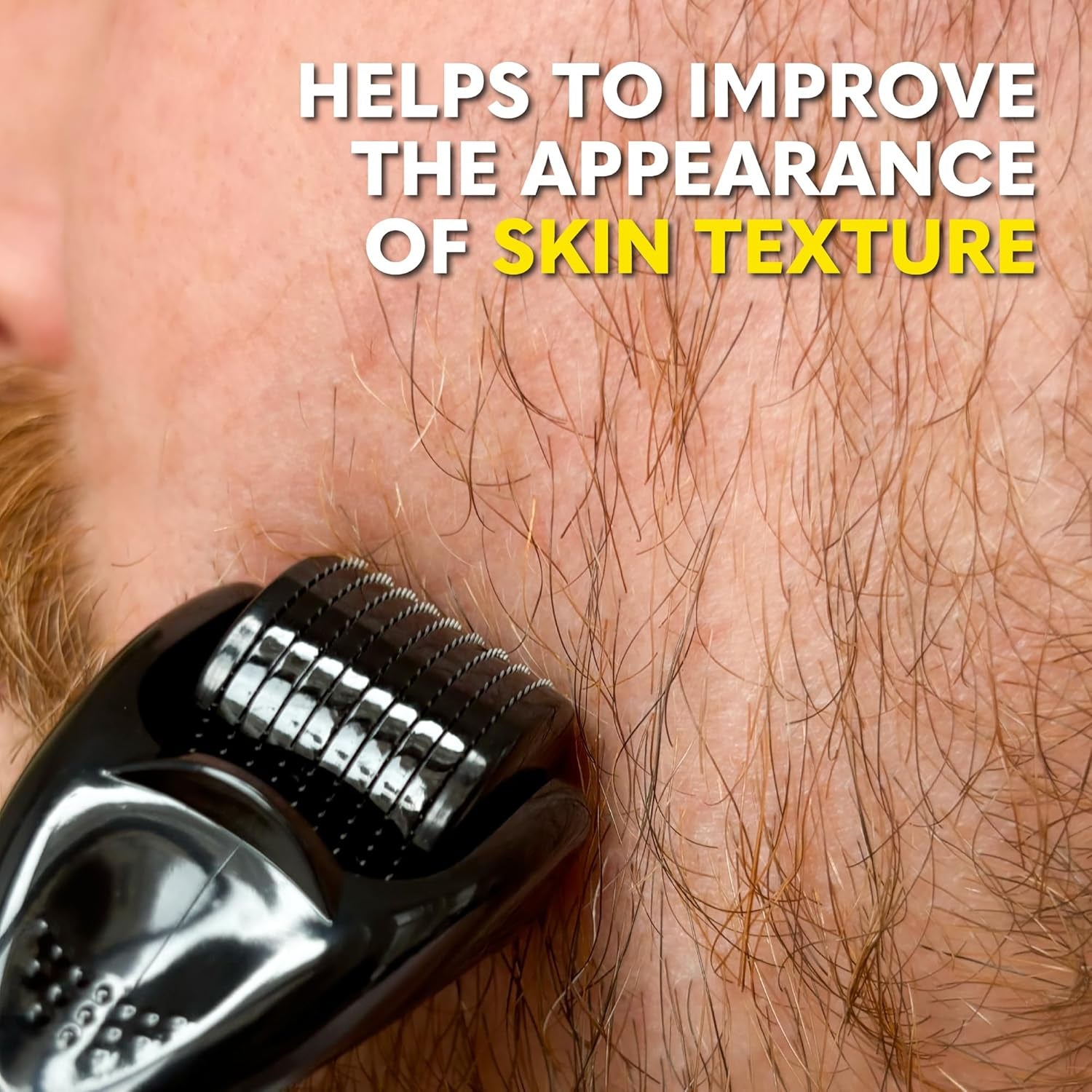 Derma Roller for Face, Body and Scalp - Microneedling for Men and Women with 540 Titanium Microneedles - Beard Roller & Micro Needling Scalp Hair - Black